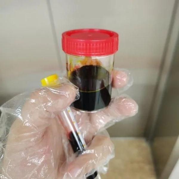 急性肝衰竭！兩兄弟誤吃這種菌 專家提醒